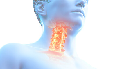 3d rendered illustration of a painful cervical spine