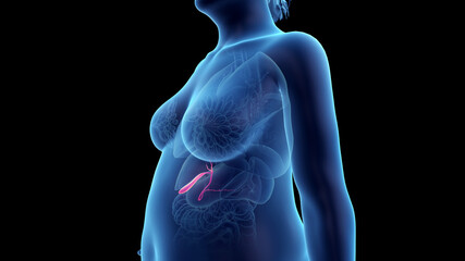 3d rendered illustration of an obese womans gallbladder