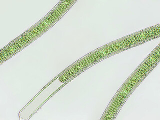 Oscillatoria algae under microscopic view x40, cyanobacteria, blue-green algae