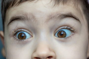 a surprised kid eyes. beautiful big brown eyes with long lashes. close up eyes photo. little boy...