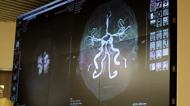 image on the screen of computed tomography of the brain in the clinic. X-ray radiation research.