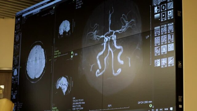 image on the screen of computed tomography of the brain in the clinic. X-ray radiation research.