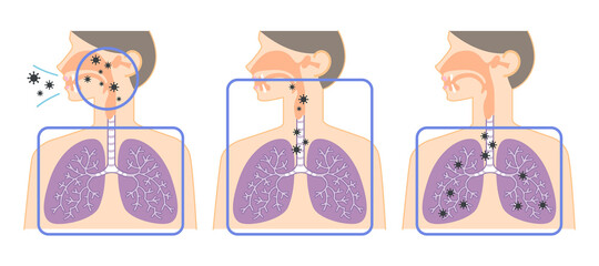 上気道から下気道へ移動するウイルスの説明イラスト（鼻・喉・肺の図表）