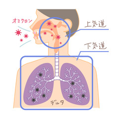 上気道と下気道へのオミクロン株の侵入（鼻・喉・肺の図表イラスト・文字あり）
