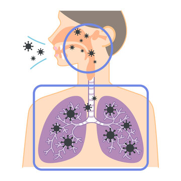 上気道と下気道へのウイルスの侵入（鼻・喉・肺の図表イラスト）