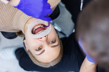A woman's teeth with metal braces are being treated at the clinic. An orthodontist uses dental instruments to place braces on a patient's teeth. Selective focus