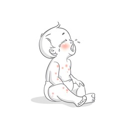 Cute little baby with skin problem sitting on floor and crying. Vector cartoon illustration