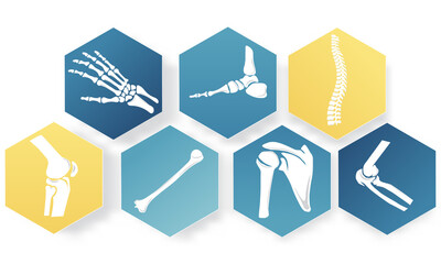 Bone set for Orthopedics traumatology with the anatomy of the bone.