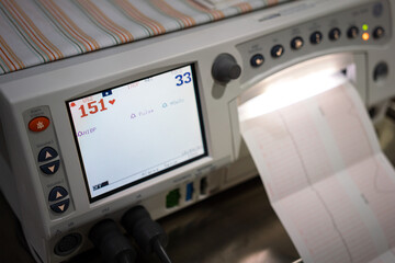 Electrocardiogram monitoring which is using to monitor heart pulse of a patient. Healthcare and medical object photo. Partial focus at the number of pulse rate on screen.