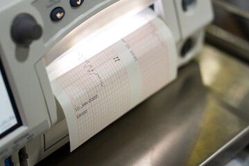Heart rate pulse (cardiogram) result graph is analyzing and printing from the monitoring equipment. Healthcare and medical object photo. Partial focus at graph's line.