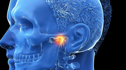 3d rendered illustration of a painful temporomandibular joint - 479786261