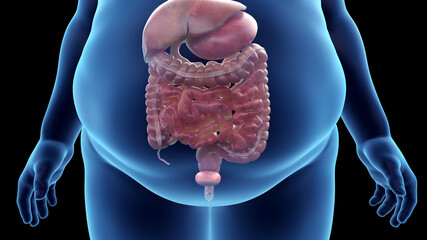 3d rendered illustration of an obese mans abdominal organs