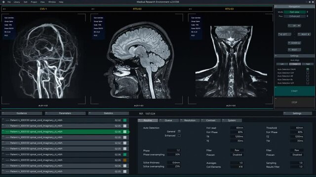 Medical Software Interface Showing Real-Time Process of Magnetic Resonance Image Scan of the Brain. Authentic MRI Helps Diagnose Neurological Disease, tumors, injury, dstroke, infection, headache
