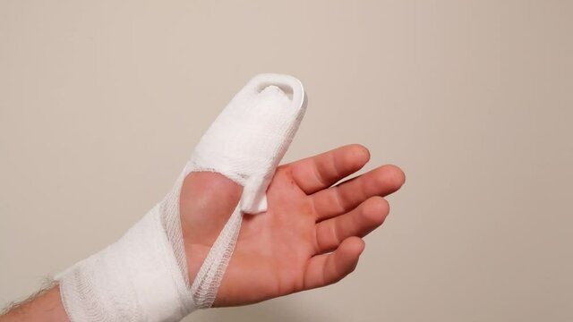 White bandages and a splint on the arm.Broken arm.Bandage and splint on the finger.Bandaged hand.Fractures and sprains.Medicine concept. Surgical dressing. 4k footage