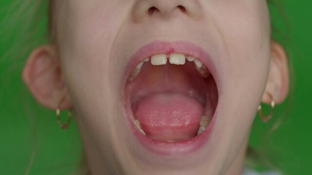 Cute school-age girl at an appointment with a doctor, a jaw surgeon or an orthodontist. Child opens his mouth wide and sticks out his tongue for inspection. Extreme close-up on green screen background
