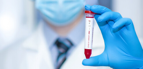 Doctor holding a test blood sample tube positive with IHU variant or strain COVID-19.