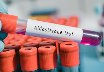 Aldosterone hormone test Regulates salt, water balance, and blood pressure