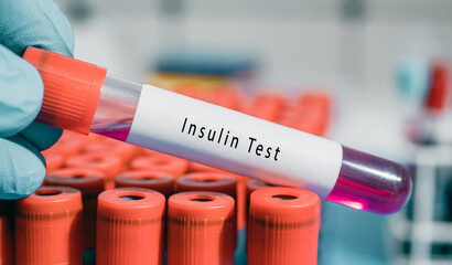 Pancreas Insulin Test Lowers blood sugar levels; stimulates metabolism of glucose, protein, and fat