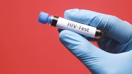  hand in latex gloves holding HIV blood test tube 
