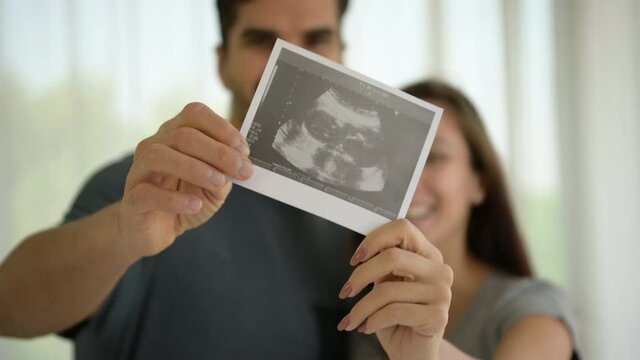 The happiness of a pregnant woman and her husband with the ultrasound film of the fetus that shows the results that the child is healthy