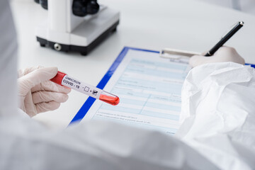 cropped view of blurred doctor with positive covid-19 omicron variant test writing on clipboard in...