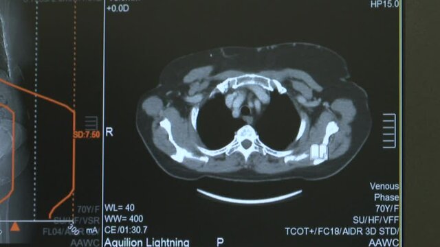 MRI scan screen animation. Computed medical tomography MRI. Diagnosis medical data