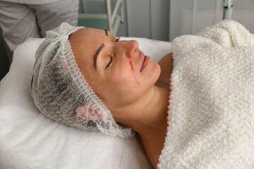 Fototapeta na wymiar Woman in a beauty salon on a facial rejuvenation procedure