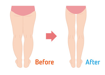 Diet before and after body illustration