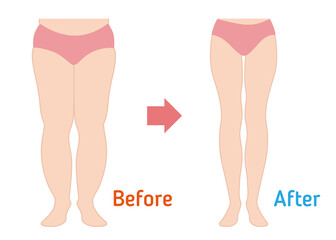 Diet before and after body illustration