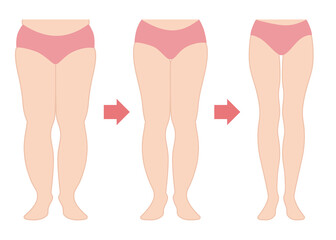 Diet before and after body illustration