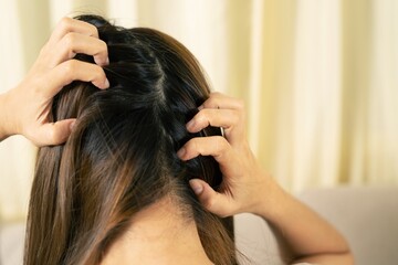 Some of the chemicals used in some hair products and treatments can be allergic to you and can make your scalp itchy.