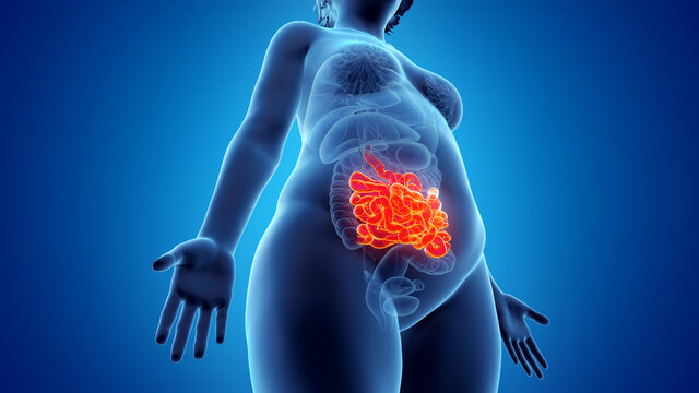 3d rendered illustration of an obese womans small intestine