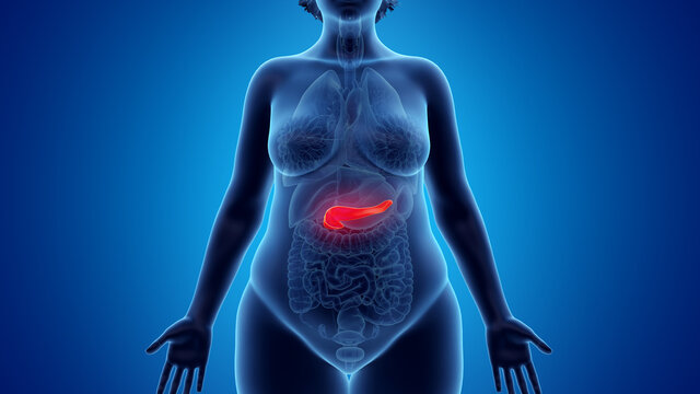 3d rendered illustration of an obese womans pancreas