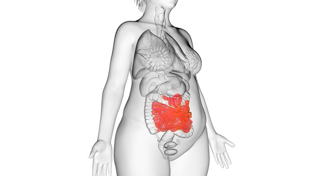 3d rendered illustration of an obese womans small intestine