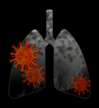 x ray of lungs with red virus inside
