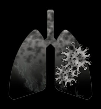 x ray of lungs with virus inside