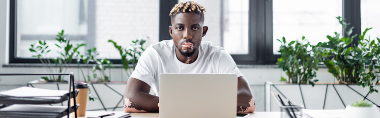 african american man with vitiligo skin and trendy hairstyle looking at camera near laptop in office, banner.