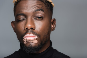 close up portrait of african american man with vitiligo and one closed eye looking at camera isolated on grey.