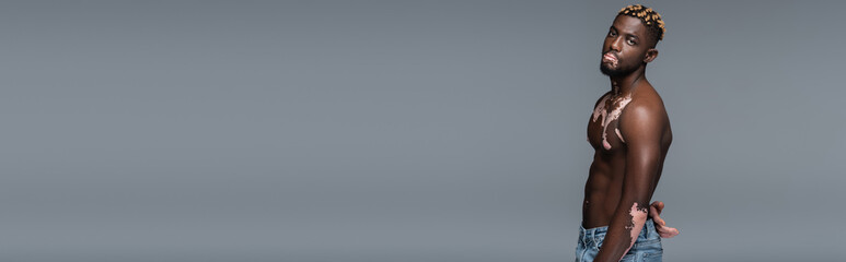 Fototapeta premium young african american man with vitiligo skin and muscular torso looking at camera isolated on grey, banner.