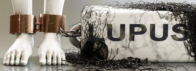 Lupus that entraps, limits life, enslaves and brings psychological weight, symbolized by a heavy, decaying stone with word Lupus and black, poisonous ivy., 3d illustration