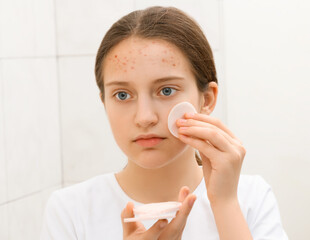 face of a teenage girl, she looks at herself in the mirror and takes care of her skin, does...