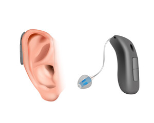 BTE divices with an external receiver. Hearing aid behind the ear. Treatment and prosthetics in otolaryngology. Realistic Vector illustration