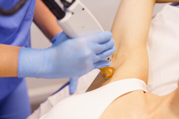 Obraz na płótnie Canvas Woman receiving underarm laser hair removal at a beauty center.