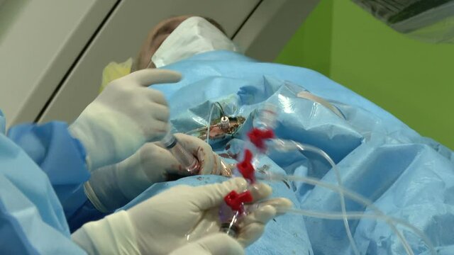 Instruments in action during abdomen surgery. Team of doctors cooperating while performing laparoscopic intervention in hospital operating room 

