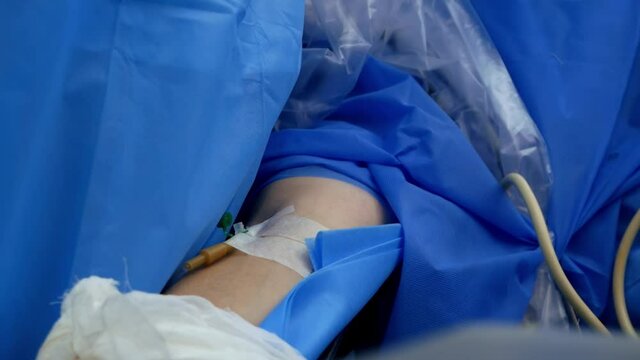Close-up of a venous catheter in the arm of a patient under general anesthesia during a surgical operation in an operating room in a hospital.