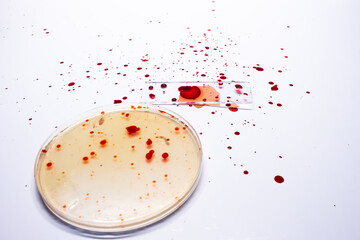 petri dish and glass with blood contamination white background
