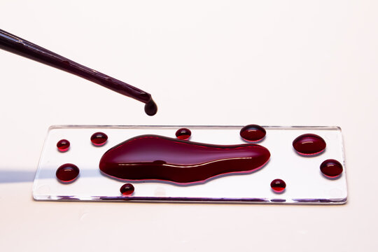 syringe with blood on top of glass