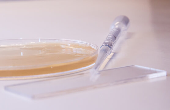 petri dish and syringe with white background