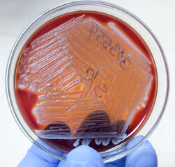 Colonies of bacteria in petri dish (blood agar), mixed bacterial colonies.
