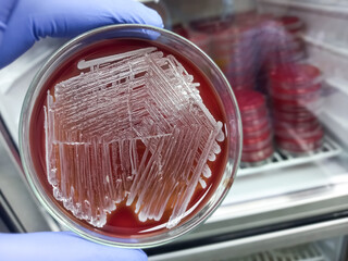Colonies of bacteria in petri dish (blood agar), mixed bacterial colonies, microbiology laboratory...